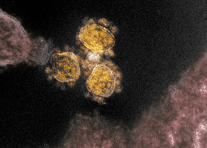 Biến thể tương lai của SARS-CoV-2 có thể "né" phản ứng miễn dịch ảnh 1