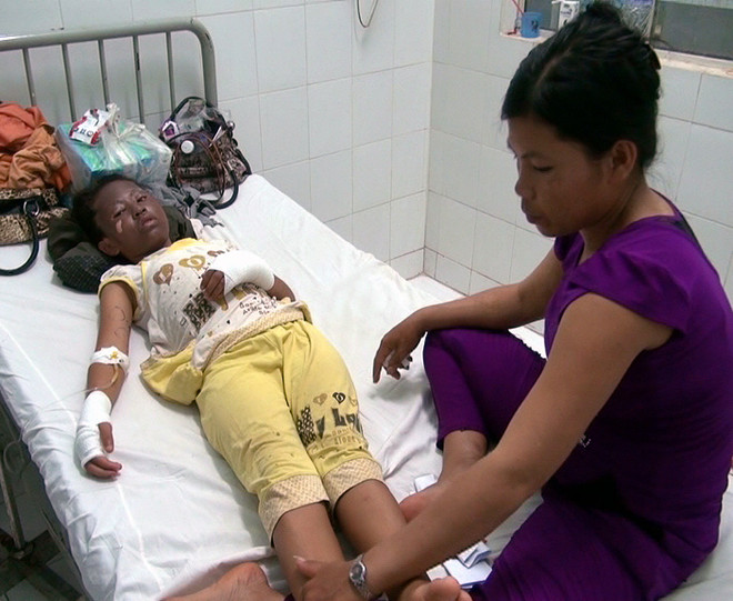 [Photo] 10 giáo viên và học sinh bỏng nặng do nổ bóng bay ảnh 3