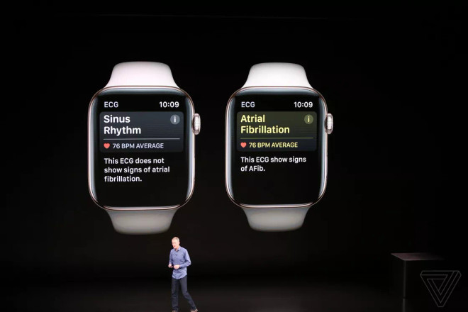 Apple ra mắt đồng hồ Apple Watch Series 4 màn hình tràn viền ảnh 2