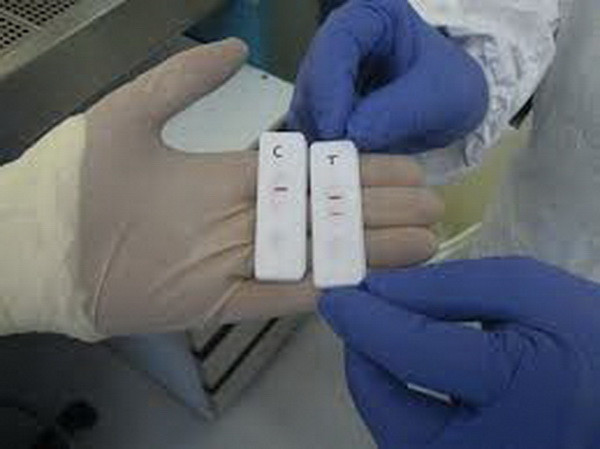 Pháp chế tạo thiết bị phát hiện virus Ebola trong vòng 15 phút ảnh 1