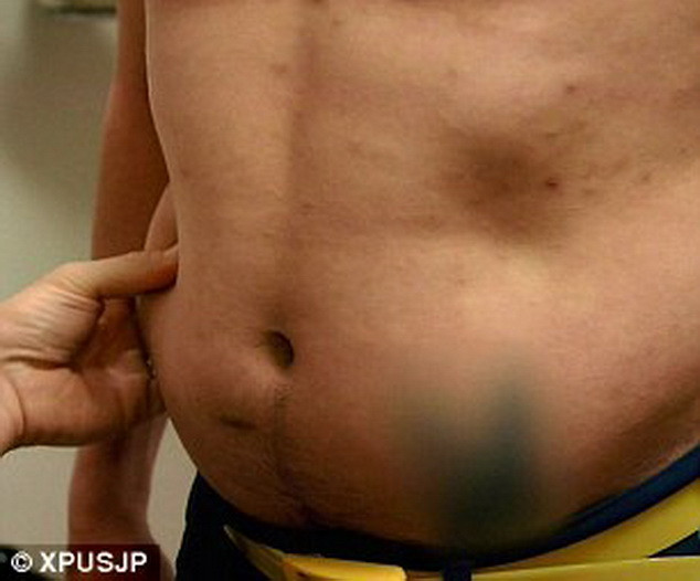 Liều mạng phẫu thuật 23 lần để có ngoại hình giống siêu nhân ảnh 5