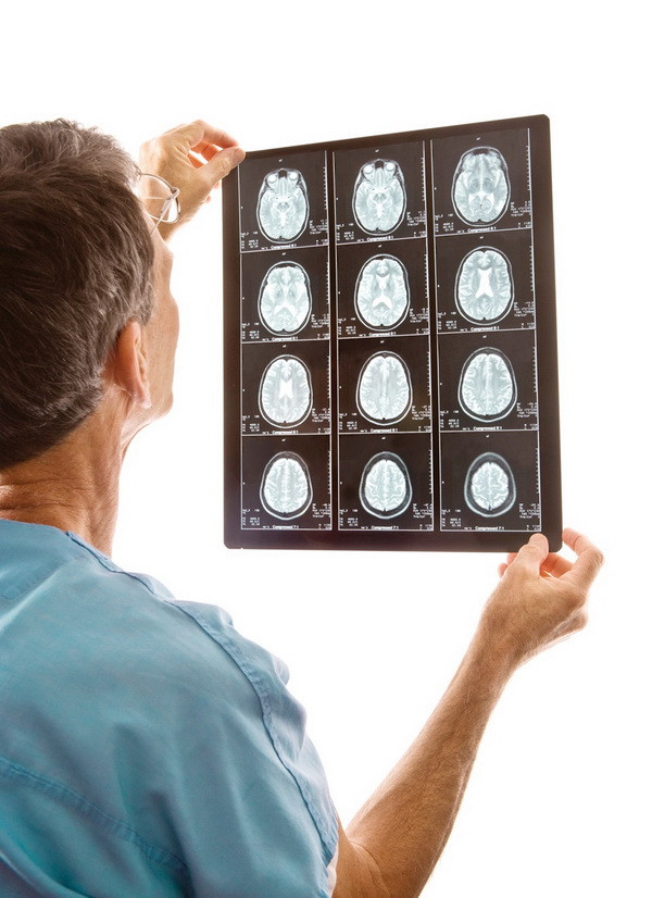 Những điều cần biết để phòng tránh chứng đột quỵ ở người trẻ ảnh 3