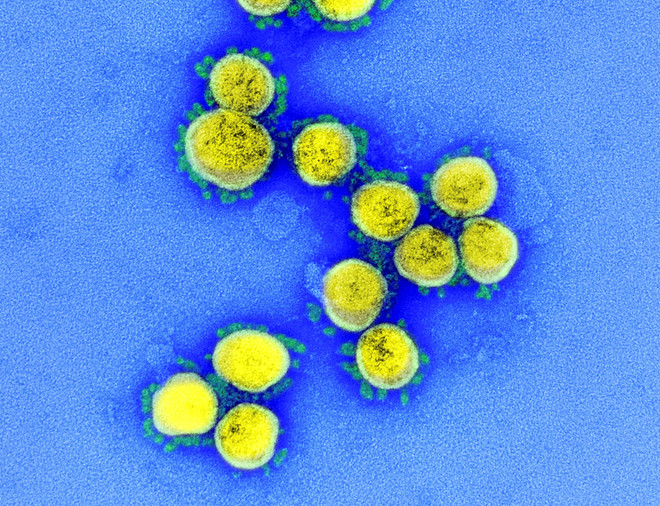 Phát hiện những đột biến "bí ẩn" của SARS-CoV-2 trong nước thải ảnh 1