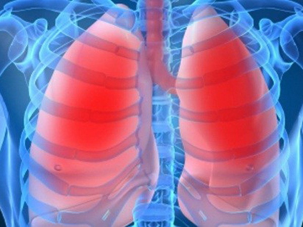 Ăn gì để giúp bạn tránh khỏi việc mắc bệnh phổi tắc nghẽn mãn tính ảnh 1