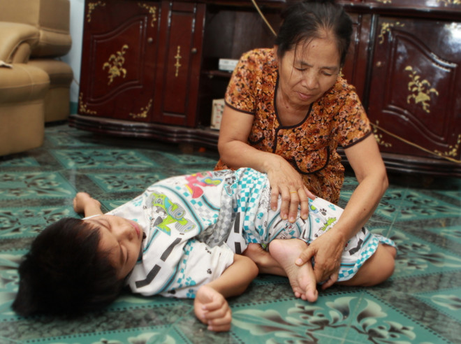 Khởi động chương trình tặng quà Tết cho nạn nhân da cam ảnh 1