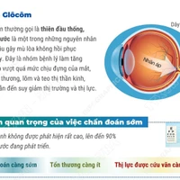 Chủ động khám mắt định kỳ để chẩn đoán sớm bệnh bệnh Glôcôm