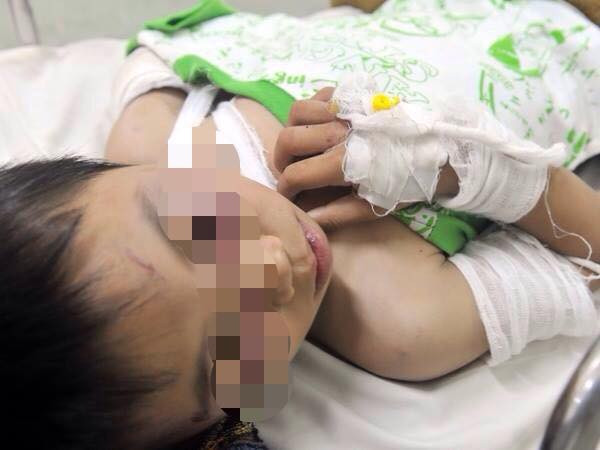 Bé trai bị cha dượng bạo hành đang trong tình trạng nguy hiểm ảnh 1