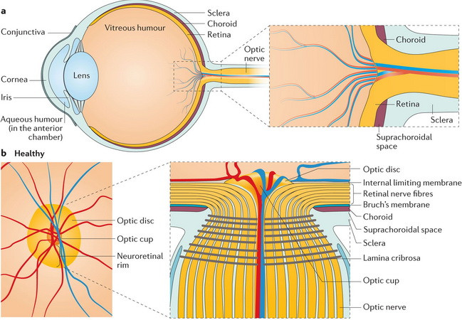 Xác định được 40 chuỗi ADN gây bệnh glaucoma dẫn tới mù lòa ảnh 1