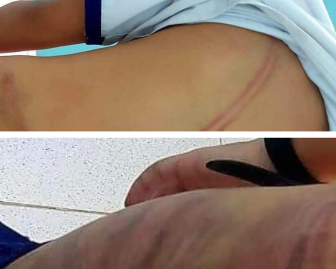 Cà Mau: Khẩn trương bảo vệ cháu bé bị mẹ kế bạo hành ảnh 1