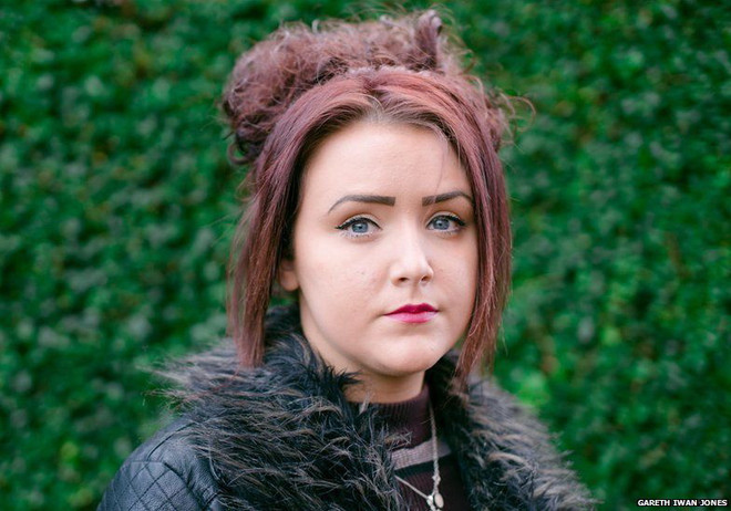 Đau lòng cô gái 17 tuổi liên tục chảy máu mắt không rõ lý do ảnh 2