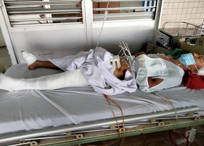 Bình Phước: Truy bắt nhóm cướp tài sản, một công an bị thương nặng ảnh 1