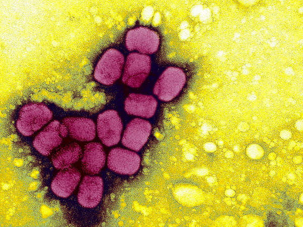 Phát hiện mẫu virus bệnh đậu mùa bị cất giữ trái phép tại Mỹ ảnh 1