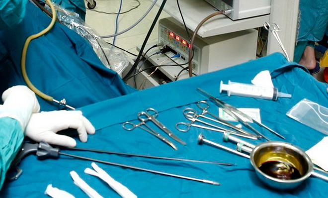 Một bệnh nhân tử vong sau khi được phẫu thuật lấy dụng cụ chỉnh hình ảnh 1