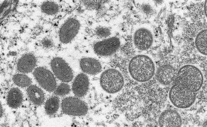 Hình ảnh virus đậu mùa khỉ dưới kính hiển vi điện tử. (Ảnh: AFP/TTXVN) Hàn Quốc ghi nhận thêm 3 ca mắc bệnh đậu mùa khỉ trong cộng đồng ảnh 1