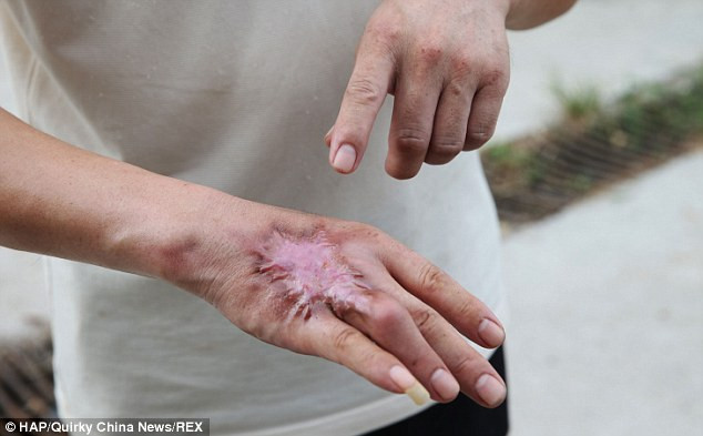 Bị cắn nhiều lần nhưng vẫn quyết nuôi 30.000 con rắn hổ mang ảnh 3