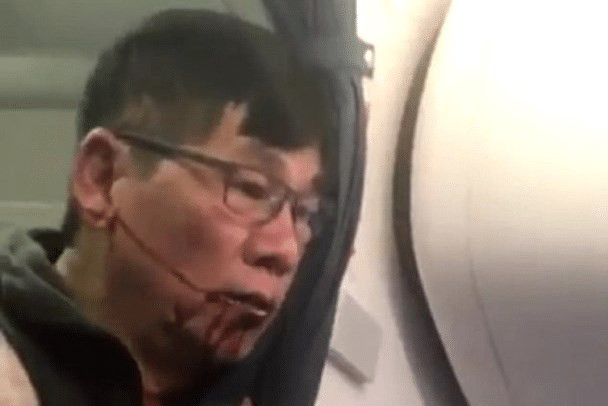 United Airlines nhận thêm loạt chỉ trích vì vụ hành khách gốc Việt ảnh 1