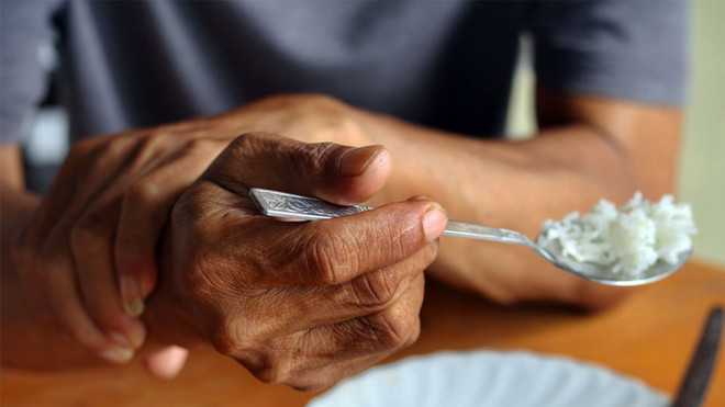 Các nhà khoa học Bỉ giải mã thành công bệnh Parkinson ảnh 1