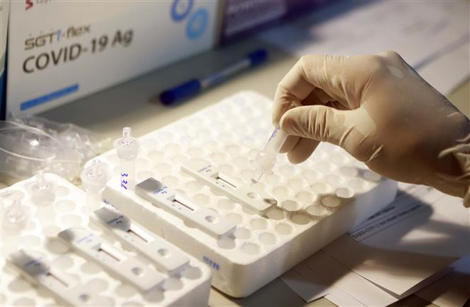 Nhỏ mẫu bệnh phẩm để test COVID -19 tại khu vực xét nghiệm COCID -19 lưu động tại đường lên Tam Đảo. (Ảnh: Hoàng Hùng/TTXVN) Nghị quyết về mua sắm vật tư, trang thiết bị phòng, chống COVID-19 ảnh 1
