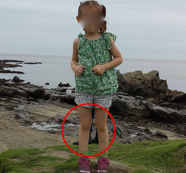 Rợn người với "đôi chân ma" trong ảnh chụp bé gái ở Nhật Bản ảnh 1