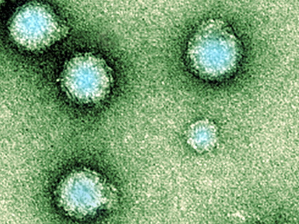Samoa: Gần 100 người dân mắc bệnh từ một loại virus lạ ảnh 1