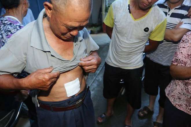 Lão nông 73 tuổi hạ gục con trăn khổng lồ chỉ bằng một tảng đá ảnh 2