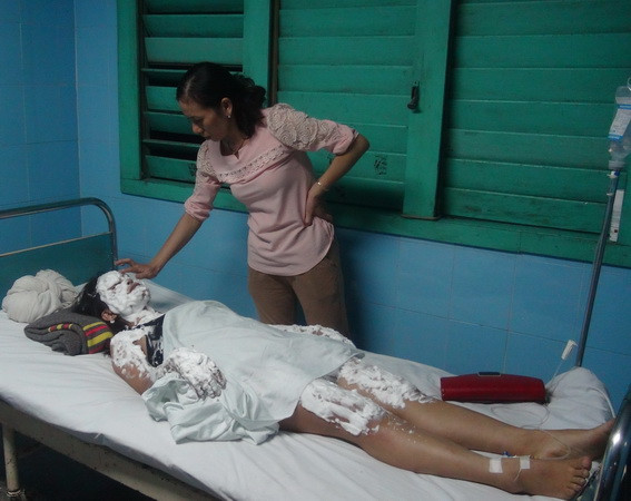 Quảng Bình: Nổ bóng bay đêm Trung Thu, 9 người nhập viện cấp cứu ảnh 2