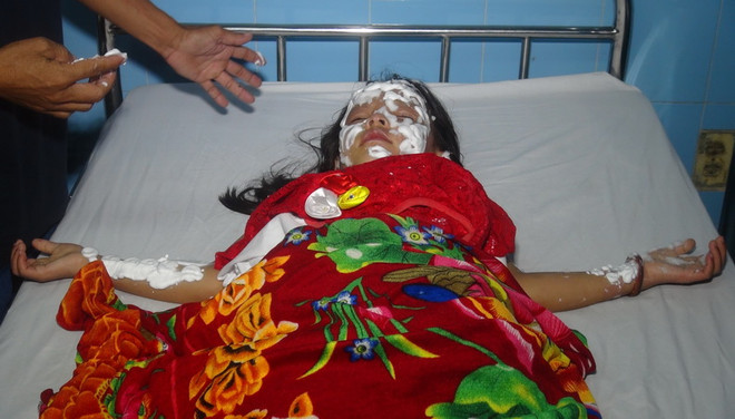 Quảng Bình: Nổ bóng bay đêm Trung Thu, 9 người nhập viện cấp cứu ảnh 3