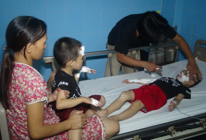 Quảng Bình: Nổ bóng bay đêm Trung Thu, 9 người nhập viện cấp cứu ảnh 1