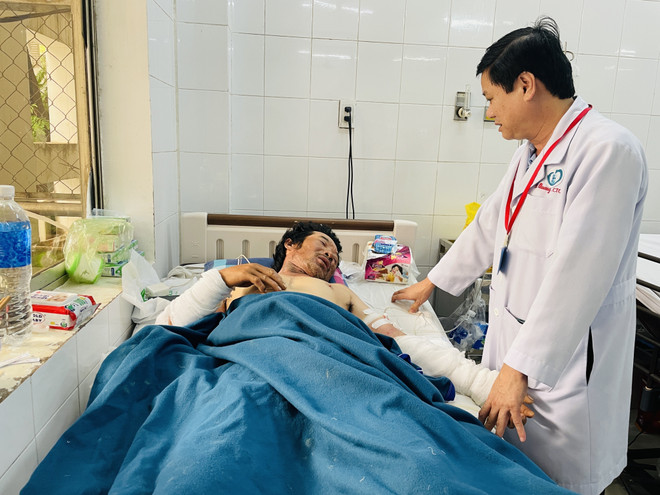 Mâu thuẫn cá nhân, thợ hồ tẩm xăng đốt quản lý công trình gây bỏng ảnh 1