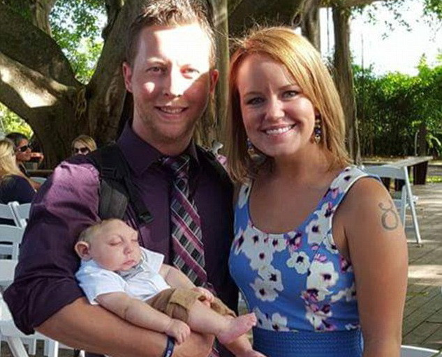 Cậu bé mất não bẩm sinh sống sót thần kỳ đón sinh nhật đầu tiên ảnh 2