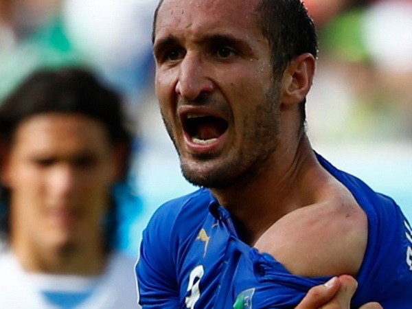 Ảnh vết răng của Suarez trên vai Chiellini là hình photoshop? ảnh 1