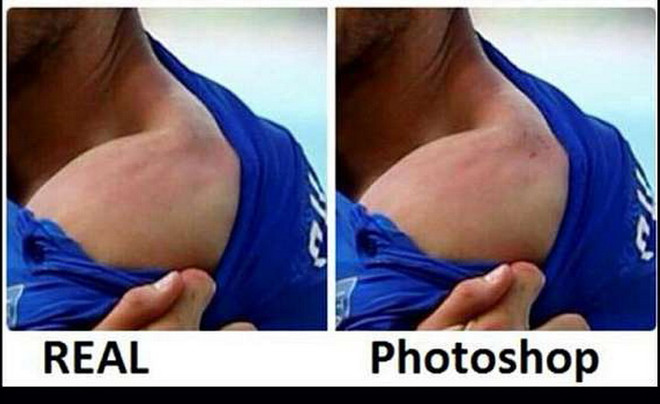 Ảnh vết răng của Suarez trên vai Chiellini là hình photoshop? ảnh 2