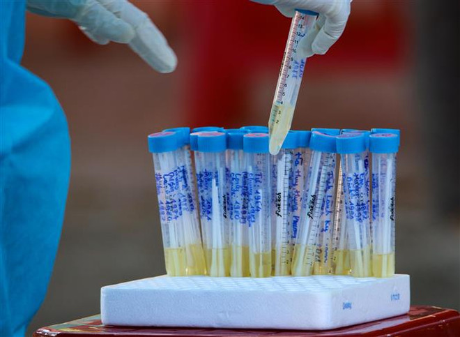 Các trường hợp liên quan đến bệnh nhân 727 và 736 đều âm tính ảnh 1