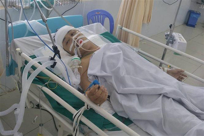 Đồng Nai: Cứu sống bệnh nhân bị đâm thủng phổi, xuyên sọ não ảnh 1