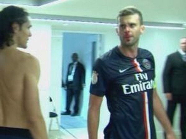 Tiền vệ PSG bị đồng hương húc vỡ mũi ngay trong đường hầm ảnh 1