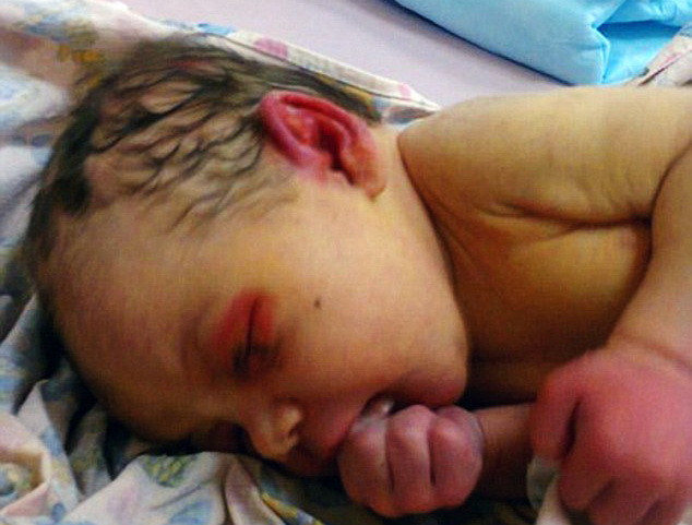 Bé gái 3 ngày tuổi may mắn sống sót khi bị bỏ rơi trong rừng ảnh 1