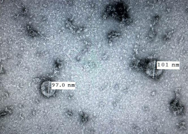 Quý II năm 2022, Việt Nam mới có thể cung ứng rộng rãi vắcxin COVID-19 ảnh 1