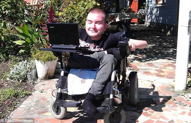 Bác sỹ Trung Quốc muốn phẫu thuật cấy ghép đầu trên khỉ ảnh 2