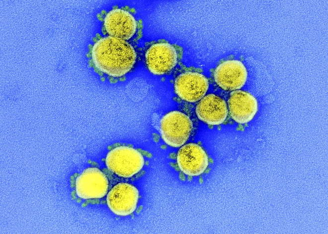 Những triệu chứng thường xuất hiện khi nhiễm biến thể Omicron ảnh 1