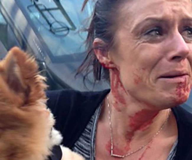 Một phụ nữ đổ máu để bảo vệ tính mạng chú chó cưng ảnh 1