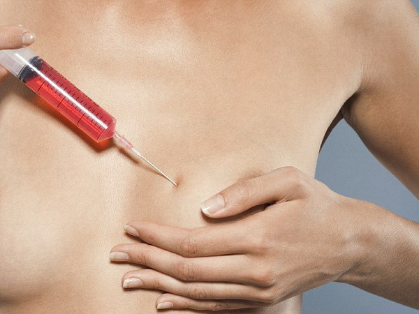 Nâng ngực tạm thời bằng nước muối ẩn chứa nhiều nguy cơ ảnh 1