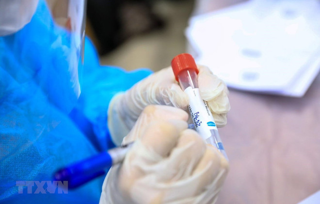 Tiền Giang có 44 cơ sở y tế thực hiện test nhanh SARS-CoV-2 ảnh 1