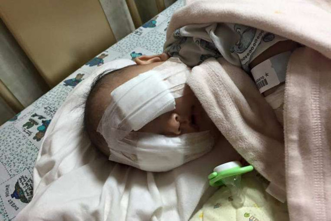 Xót xa em bé 4 tháng tuổi bị cắt bỏ đôi mắt vì bị ung thư ảnh 1
