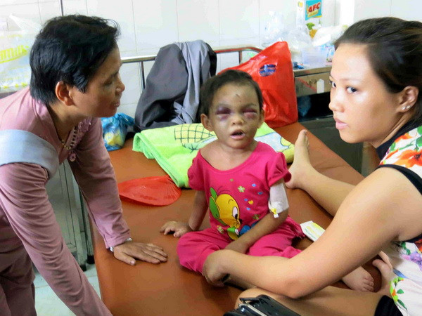 Biểu dương hai vợ chồng giải cứu bé gái 4 tuổi bị bạo hành ảnh 1