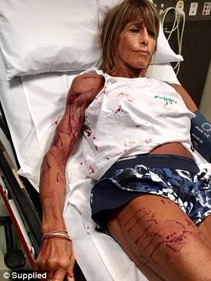 Người phụ nữ bị con chuột túi tấn công dã man trong lúc chạy bộ ảnh 2