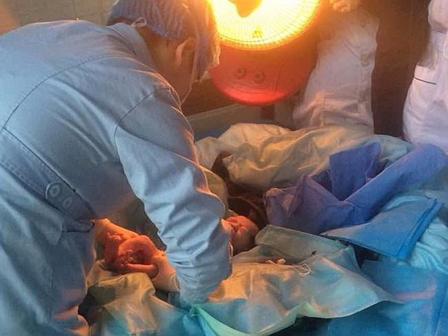 Bé sơ sinh thoát chết thần kỳ sau khi bị mẹ xả xuống bồn cầu ảnh 3