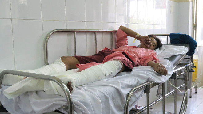 Vừa chiết xăng vừa hút thuốc lá, 4 người trong gia đình bị bỏng nặng ảnh 1