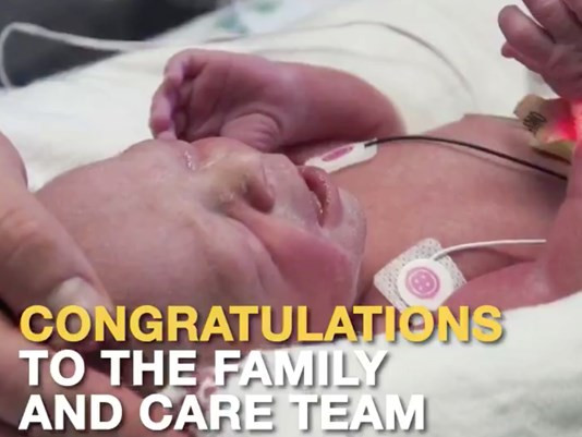 Mỹ chào đón em bé đầu tiên sinh ra từ bà mẹ được ghép tử cung ảnh 1