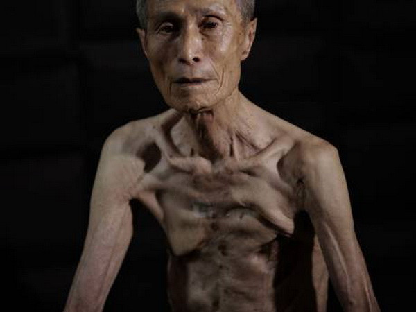 Nạn nhân bom nguyên tử ở Nagasaki kể lại những giây phút hãi hùng ảnh 2