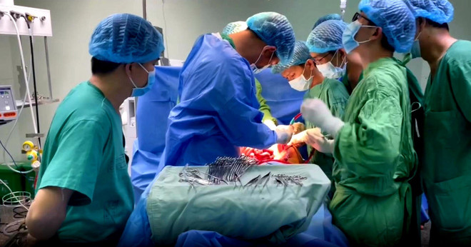 Cứu sống bệnh nhân xuất huyết tiêu hóa trên do rò động mạch chủ ngực ảnh 1